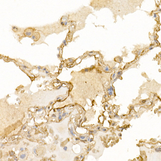 S100A10 Antibody in Immunohistochemistry (Paraffin) (IHC (P))