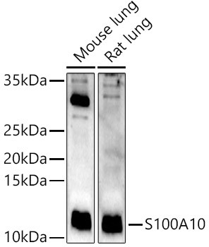 S100A10 Antibody in Western Blot (WB)