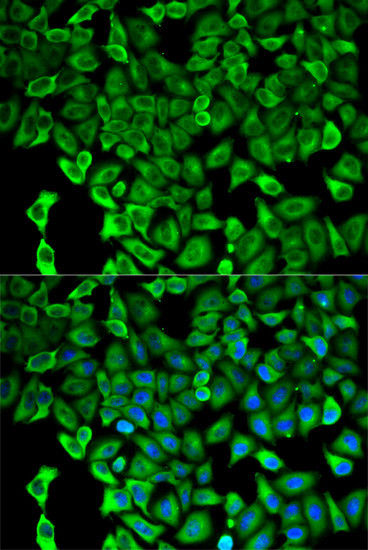 PSMD2 Antibody in Immunocytochemistry (ICC/IF)