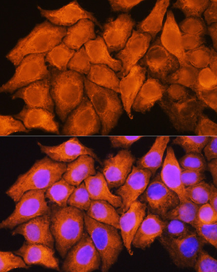 ASS1 Antibody in Immunocytochemistry (ICC/IF)