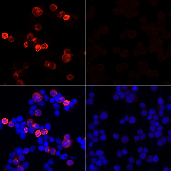 SARS-CoV-2 Spike Protein S1 Antibody in Immunocytochemistry (ICC/IF)