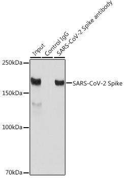 SARS-CoV-2 Spike Protein S1 Antibody in Immunoprecipitation (IP)