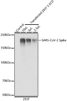 SARS-CoV-2 Spike Protein S1 Antibody in Western Blot (WB)