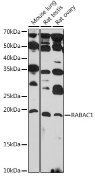 RABAC1 Antibody in Western Blot (WB)