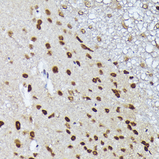 MT2A Antibody in Immunohistochemistry (Paraffin) (IHC (P))