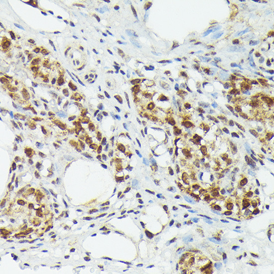 MT2A Antibody in Immunohistochemistry (Paraffin) (IHC (P))