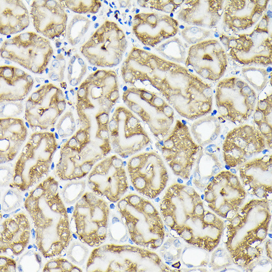 RSK1/RSK2/RSK3 Antibody in Immunohistochemistry (Paraffin) (IHC (P))