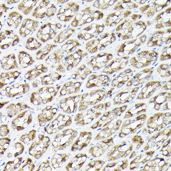 RSK1/RSK2/RSK3 Antibody in Immunohistochemistry (Paraffin) (IHC (P))