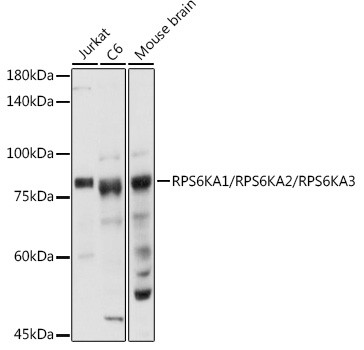 RSK1/RSK2/RSK3 Antibody in Western Blot (WB)