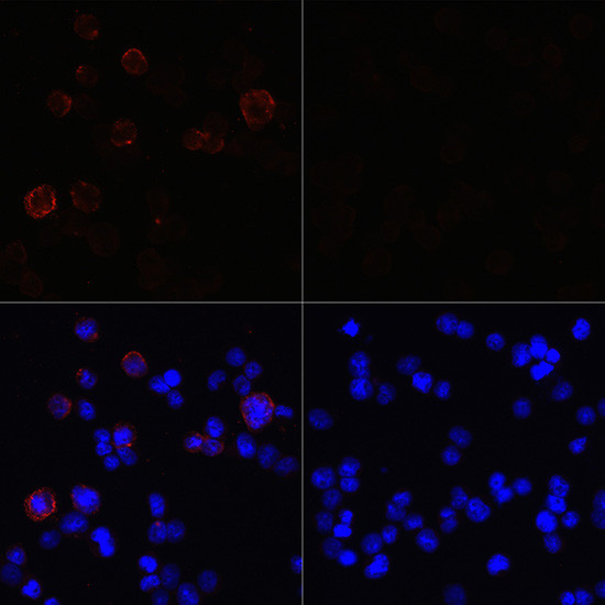 SARS-CoV-2 NSP13 Antibody in Immunocytochemistry (ICC/IF)