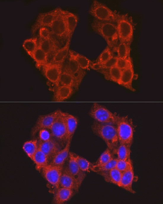 PCK1 Antibody in Immunocytochemistry (ICC/IF)