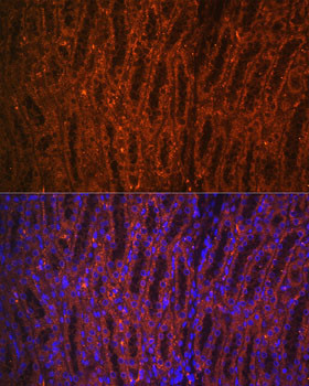 PCK1 Antibody in Immunohistochemistry (Paraffin) (IHC (P))