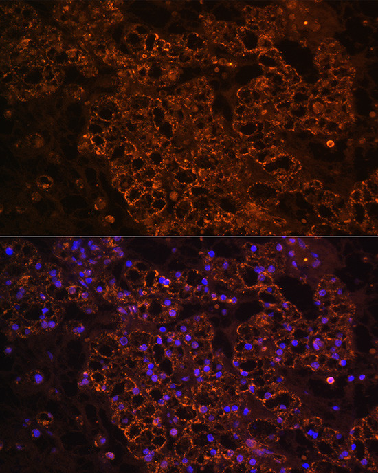 PCK1 Antibody in Immunohistochemistry (Paraffin) (IHC (P))