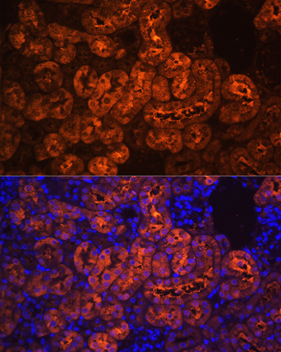 PCK1 Antibody in Immunohistochemistry (Paraffin) (IHC (P))