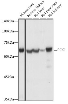 PCK1 Antibody in Western Blot (WB)