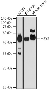 YBX2 Antibody in Western Blot (WB)