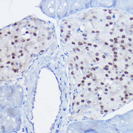 Nkx6.1 Antibody in Immunohistochemistry (Paraffin) (IHC (P))