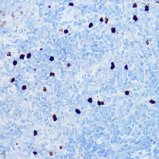 S100A8 Antibody in Immunohistochemistry (Paraffin) (IHC (P))