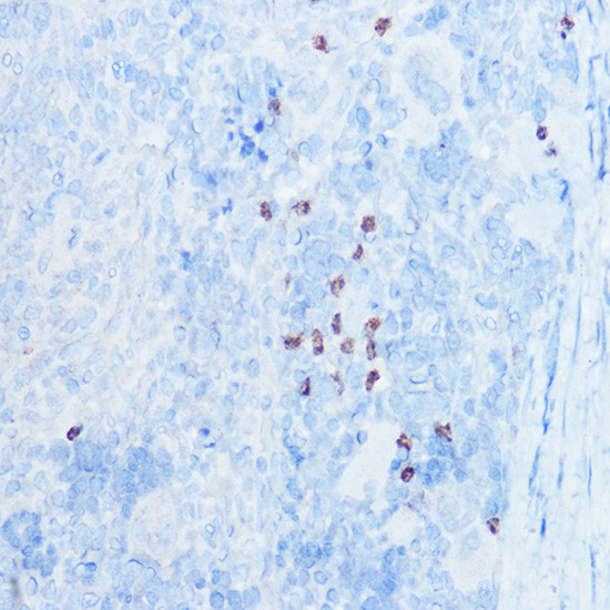 S100A8 Antibody in Immunohistochemistry (Paraffin) (IHC (P))