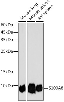 S100A8 Antibody in Western Blot (WB)