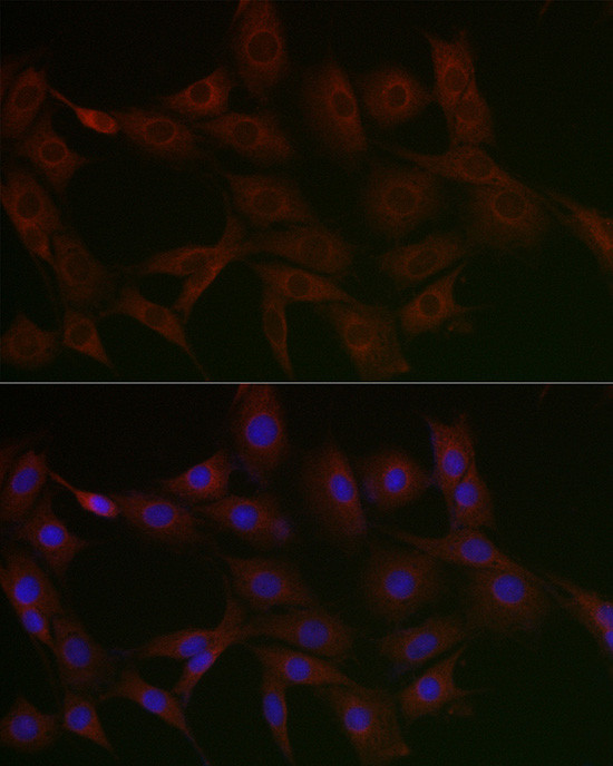 N4BP2 Antibody in Immunocytochemistry (ICC/IF)