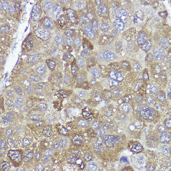 PYCARD Antibody in Immunohistochemistry (Paraffin) (IHC (P))