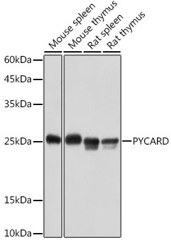 PYCARD Antibody in Western Blot (WB)