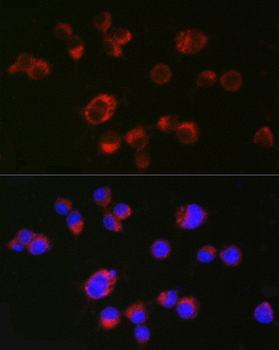 HTR2A Antibody in Immunocytochemistry (ICC/IF)