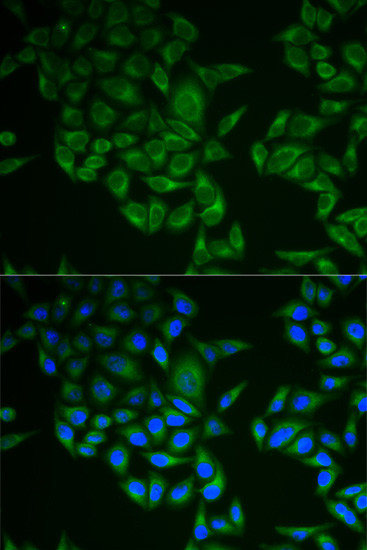 CD3 zeta (CD247) Antibody in Immunocytochemistry (ICC/IF)