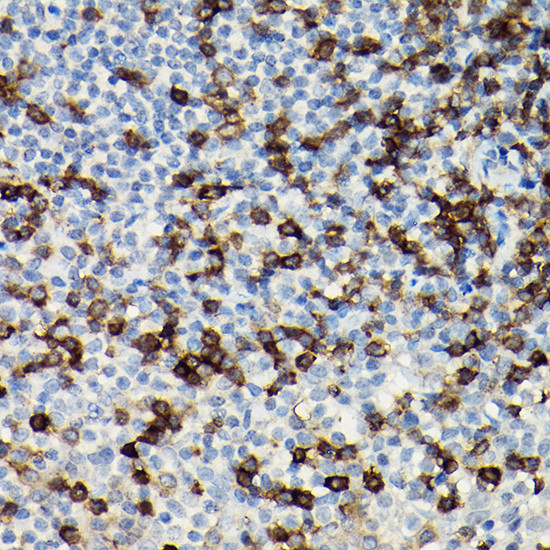 CD3 zeta (CD247) Antibody in Immunohistochemistry (Paraffin) (IHC (P))