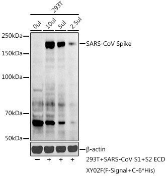 SARS Coronavirus Spike Protein Antibody in Western Blot (WB)