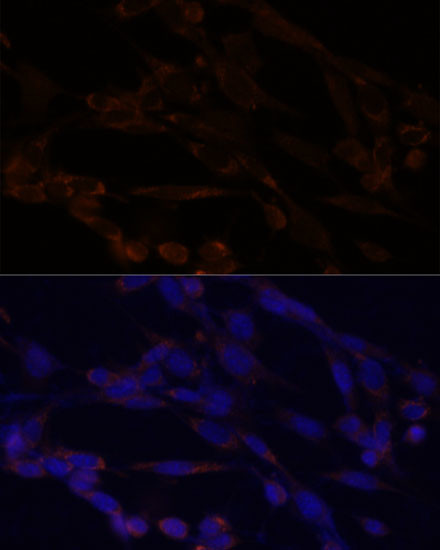 IKK alpha Antibody in Immunocytochemistry (ICC/IF)