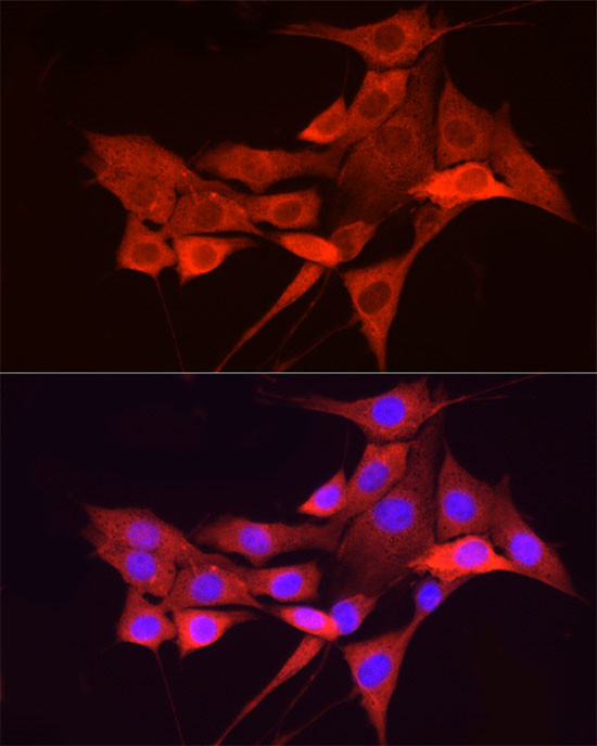 IKK alpha Antibody in Immunocytochemistry (ICC/IF)