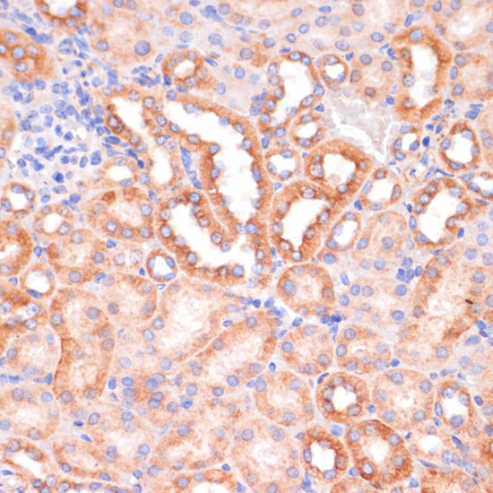 IKK alpha Antibody in Immunohistochemistry (Paraffin) (IHC (P))