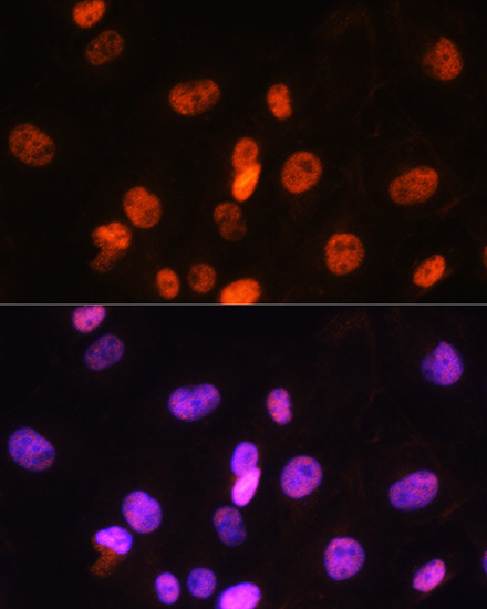 FANCD2 Antibody in Immunocytochemistry (ICC/IF)