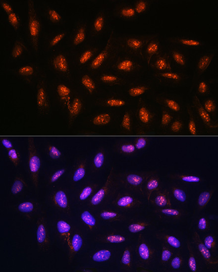 FANCD2 Antibody in Immunocytochemistry (ICC/IF)