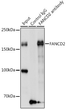 FANCD2 Antibody in Immunoprecipitation (IP)