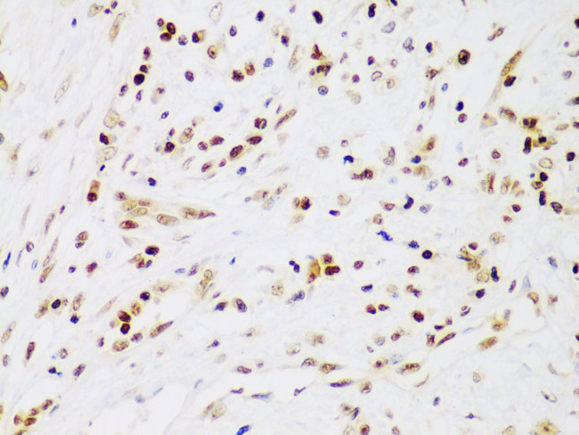 IKK beta Antibody in Immunohistochemistry (Paraffin) (IHC (P))