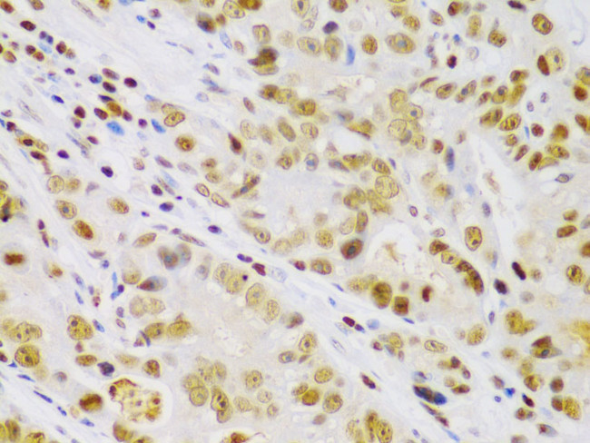 IKK beta Antibody in Immunohistochemistry (Paraffin) (IHC (P))