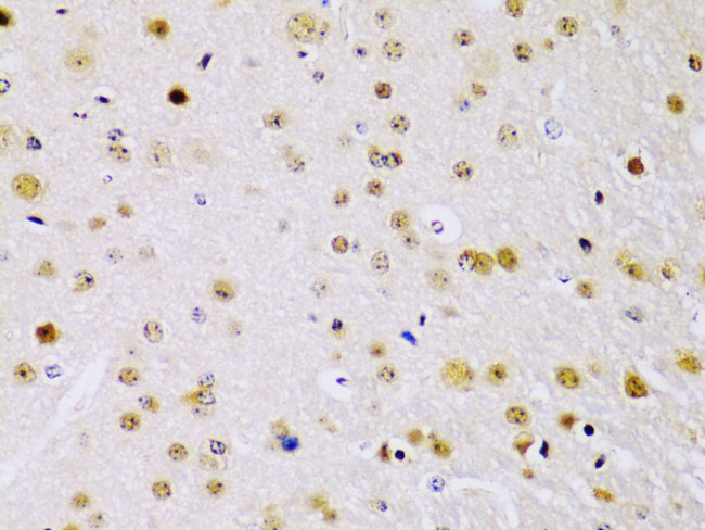 IKK beta Antibody in Immunohistochemistry (Paraffin) (IHC (P))