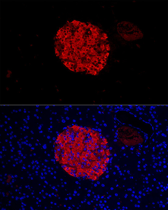 Insulin Antibody in Immunocytochemistry (ICC/IF)