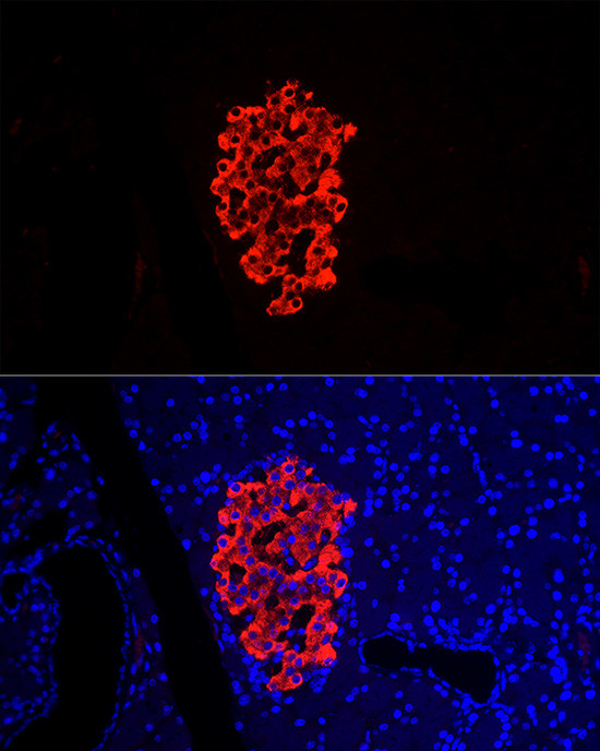 Insulin Antibody in Immunocytochemistry (ICC/IF)