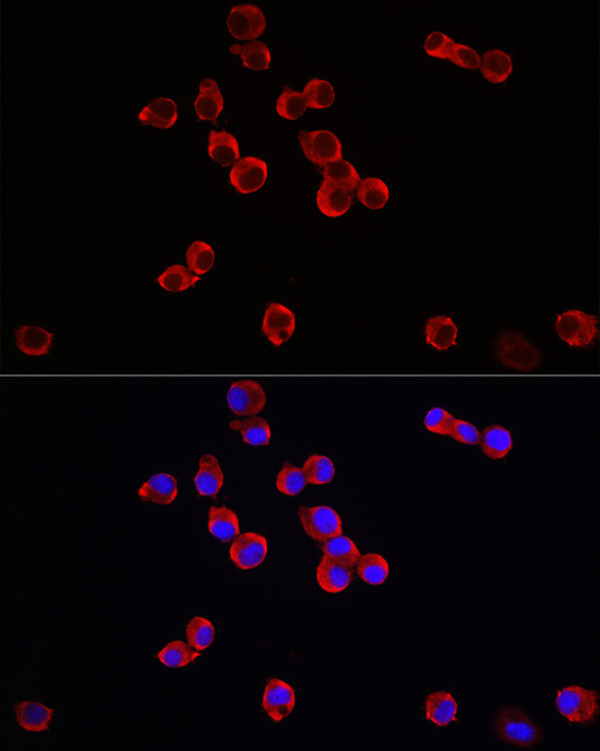 TrkB Antibody in Immunocytochemistry (ICC/IF)