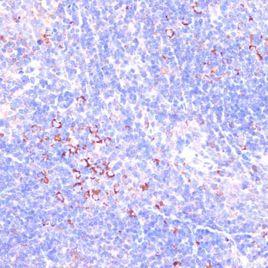 Zyxin Antibody in Immunohistochemistry (Paraffin) (IHC (P))