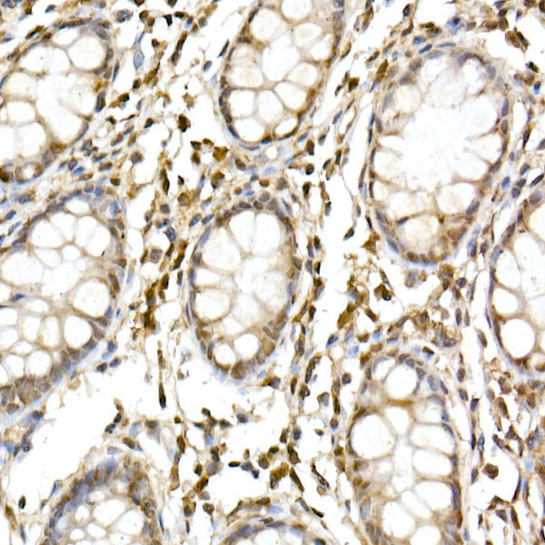 Cullin 1 Antibody in Immunohistochemistry (Paraffin) (IHC (P))