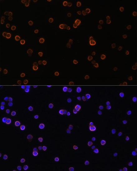 PLCG2 Antibody in Immunocytochemistry (ICC/IF)