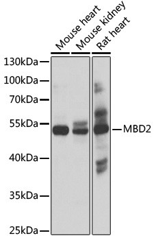 MBD2 Antibody in Western Blot (WB)