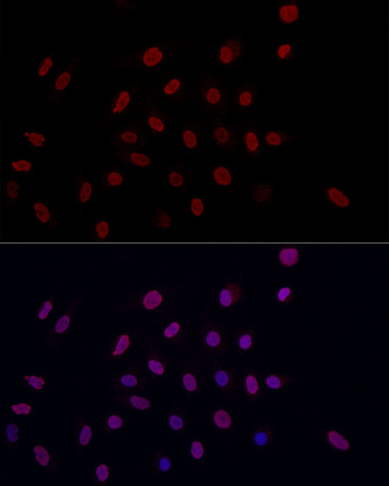 H3K9me2 Antibody in Immunocytochemistry (ICC/IF)