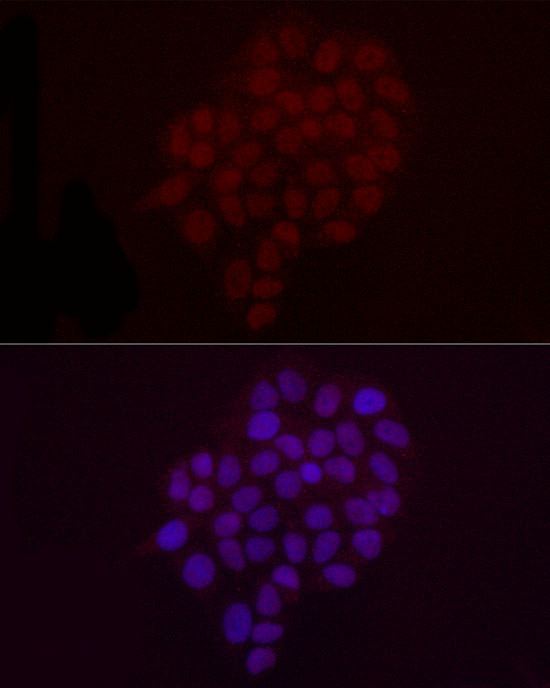 H3K9me2 Antibody in Immunocytochemistry (ICC/IF)