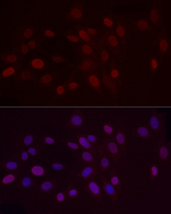 H3K9me2 Antibody in Immunocytochemistry (ICC/IF)